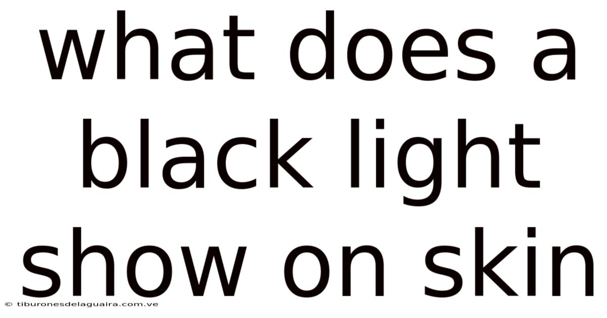 What Does A Black Light Show On Skin